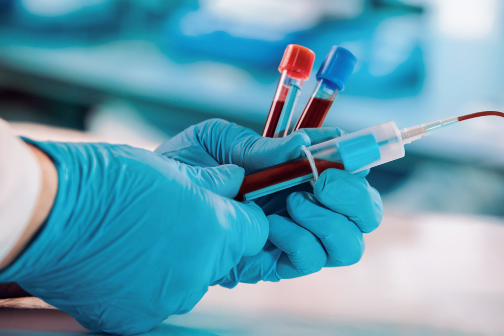 Examen  par des pairs : 94 % des patients vaccinés ayant des problèmes de santé  ultérieurs ont un sang anormal, selon une microscopie italienne