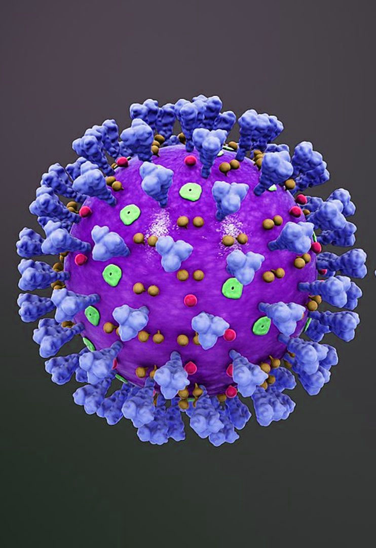 Expression de la protéine Spike du SARS-CoV-2 dans les artères cérébrales : implications pour l’AVC hémorragique après vaccination par ARNm